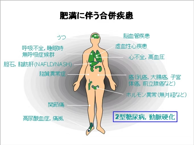 肥満に伴う合併疾患