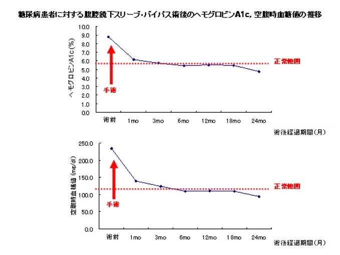 術前糖尿病合併症例に対する腹腔鏡下スリーブ・バイパス術後のHbA1cと空腹時血糖値の推移